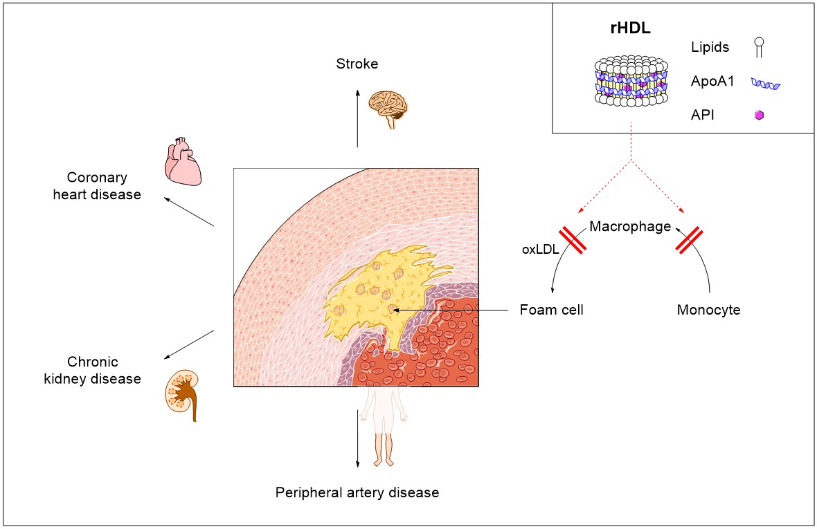 LipoproteinNP.jpg