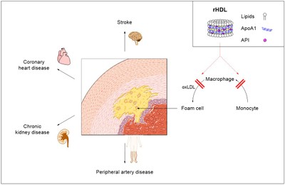 LipoproteinNP.jpg
